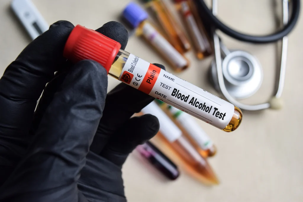 Blood sample for alcohol testing