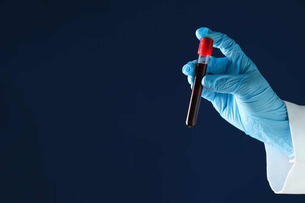 Blood sample for DUI case